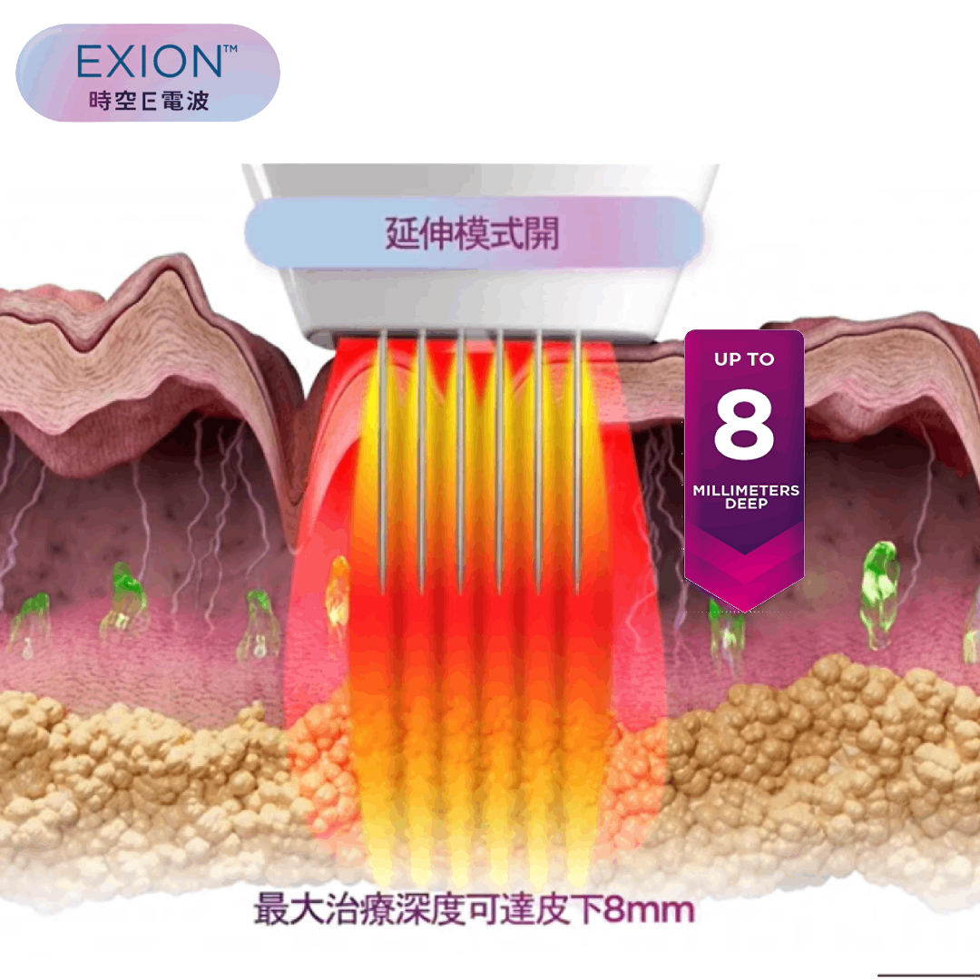 時空E電波(EXION) ，有深度的AI 智能電波，24K金微針，讓你好看，不只一點